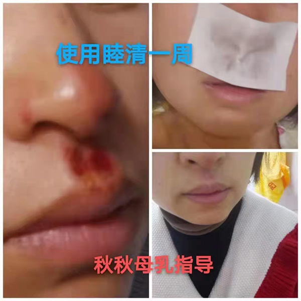 �����澏���N���Æ������M�߿ڱ������������a(ch��n)ƷȦ�۟o��(sh��)